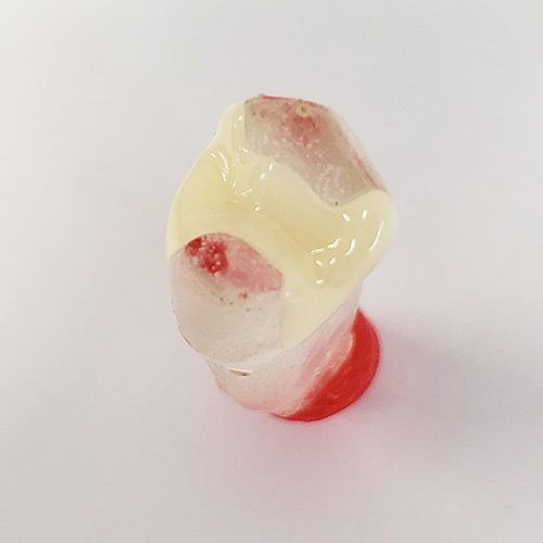 保険CAD/CAMインレー | 株式会社デンタルアクト
